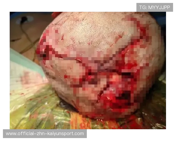 黑熊城市袭击，女子遇难令人痛惜，黑熊袭击村民视频